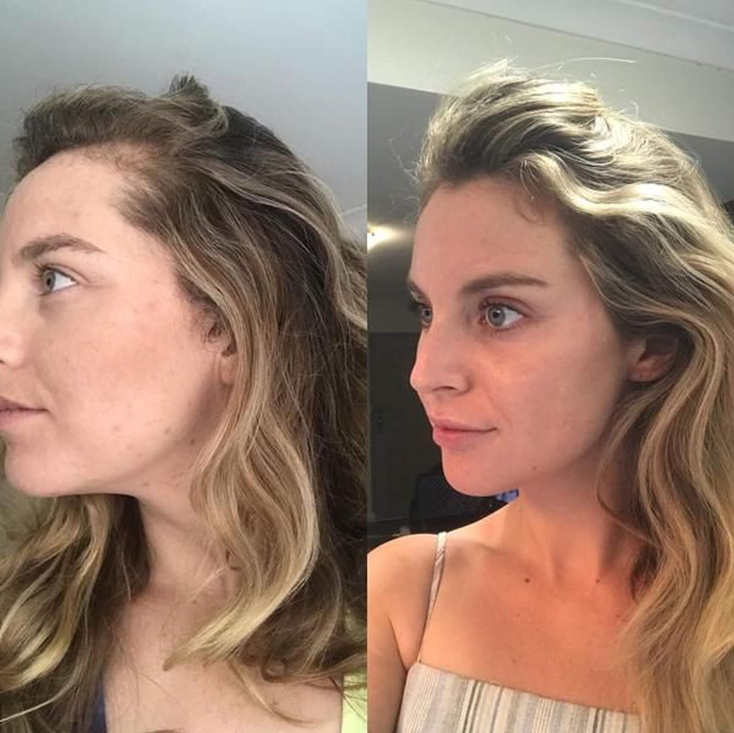 The Supplement-Hair Growth for Women