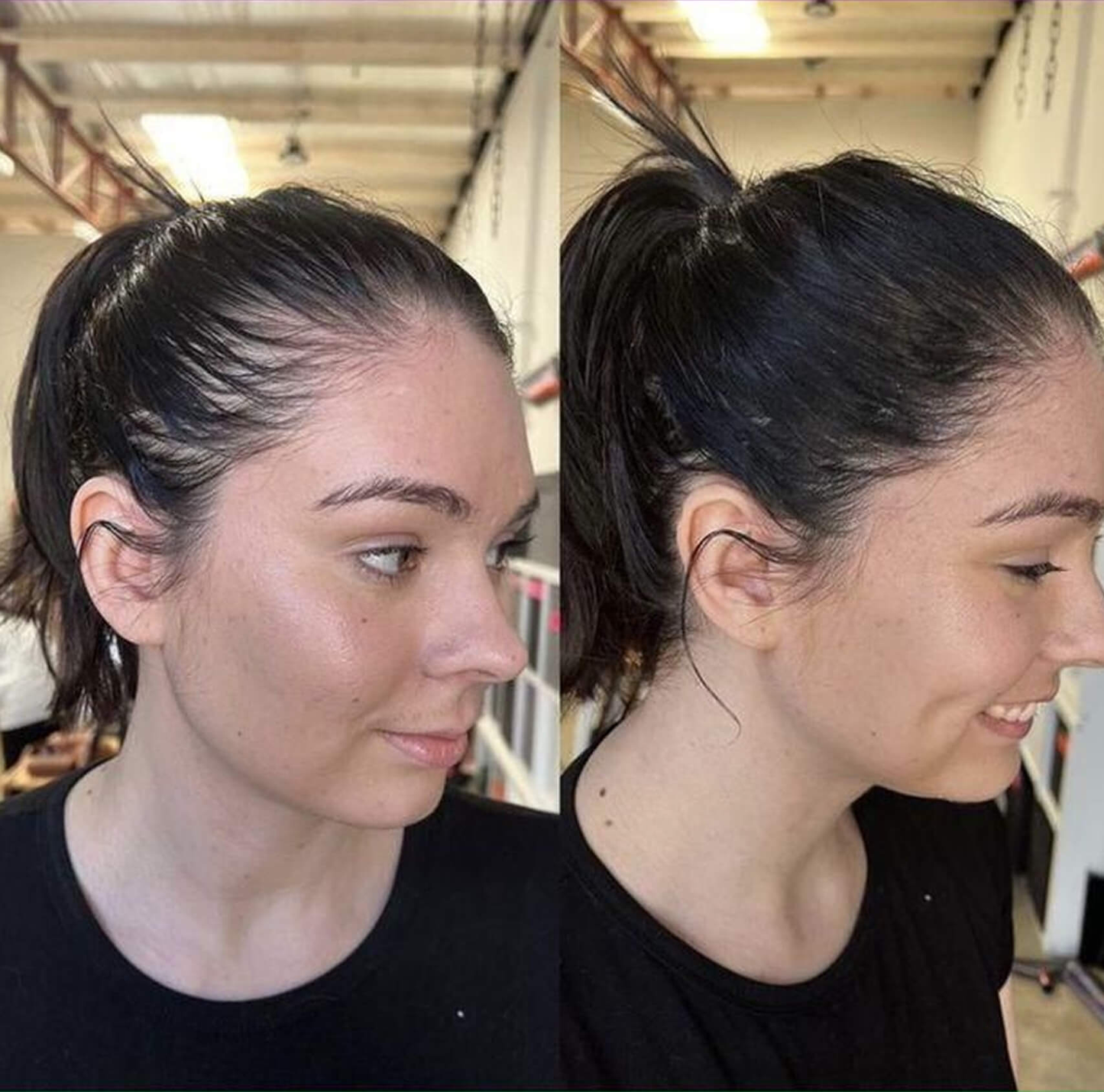The Supplement-Hair Growth for Women