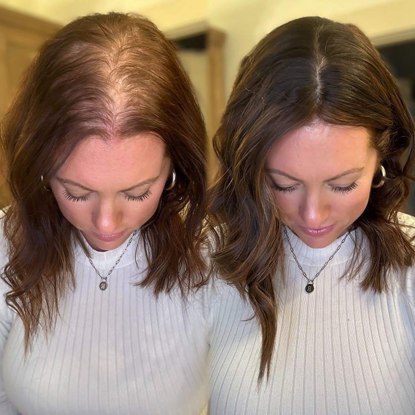 The Supplement-Hair Growth for Women