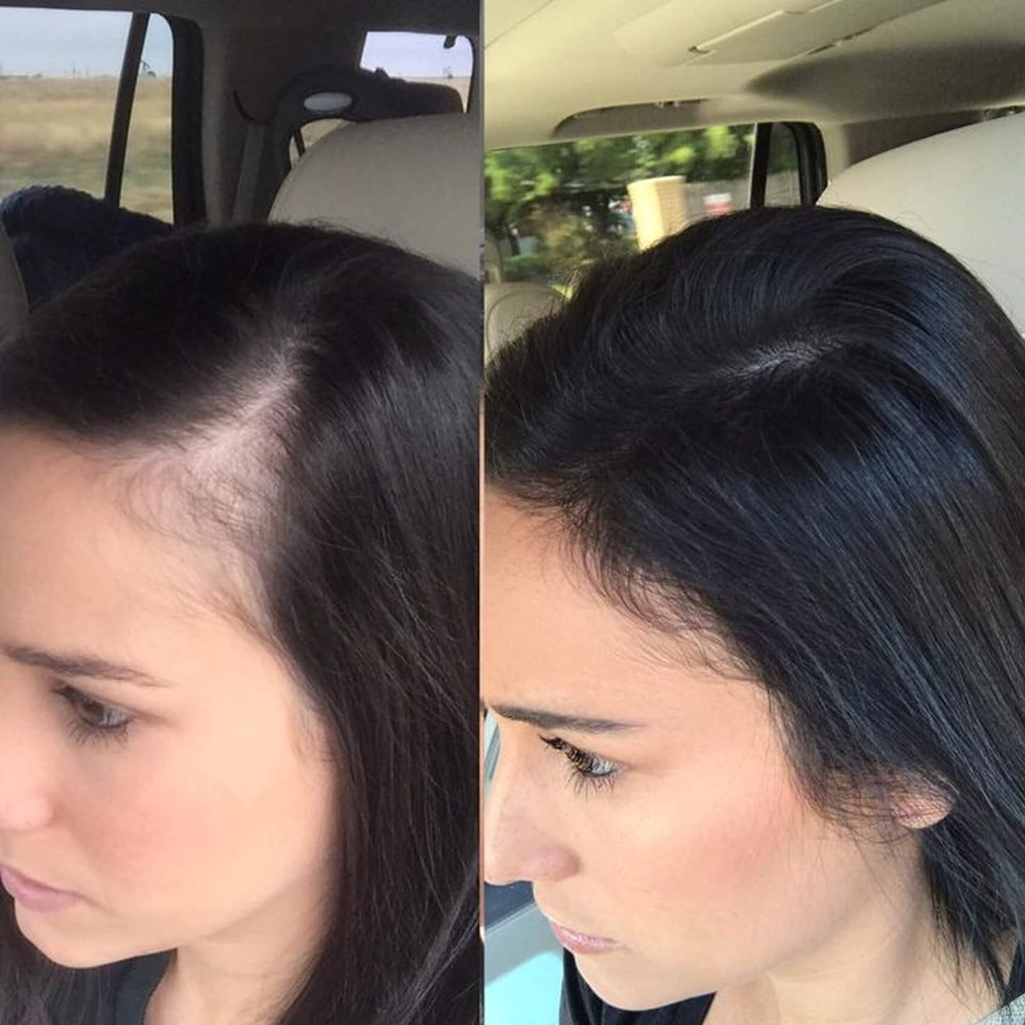 The Supplement-Hair Growth for Women